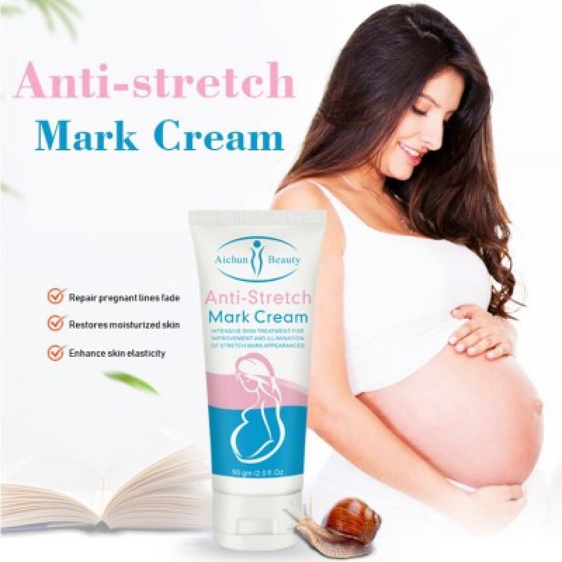 anti stretch mark cream Aichun Beauty